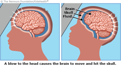 How Do Bicycle Helmets Guard Your Brain Upon Impact